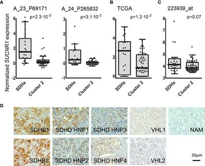 Succinate Mediates Tumorigenic Effects via Succinate Receptor 1: Potential for New Targeted Treatment Strategies in Succinate Dehydrogenase Deficient Paragangliomas